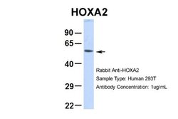 HOXA2 Rabbit anti-Human, Polyclonal, Novus Biologicals 0.1ml; Unconjugated:Antibodies,